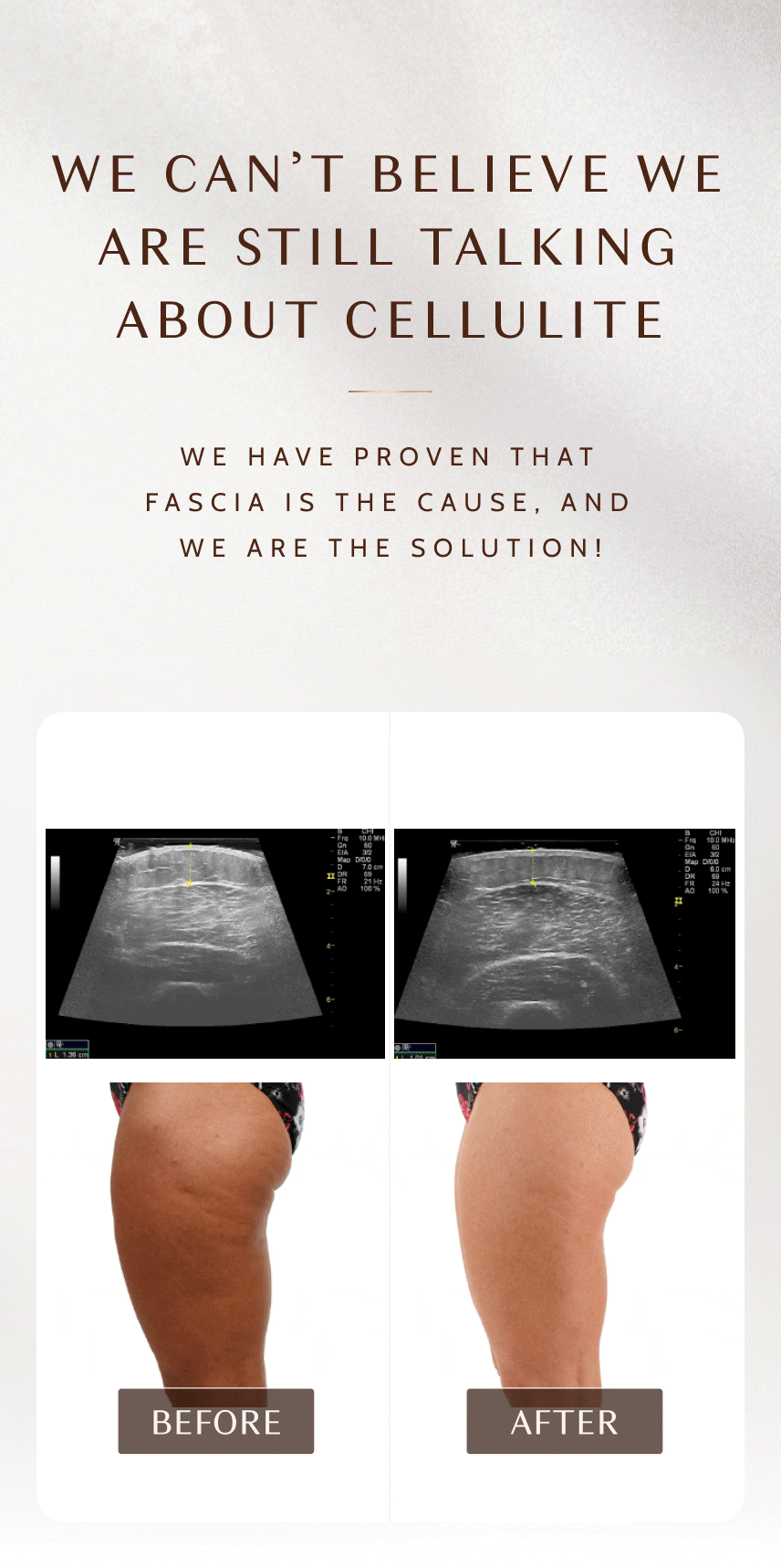 Cellulite Fascia Is The Cause & We Are The Solution!👋 Ashley Black Guru