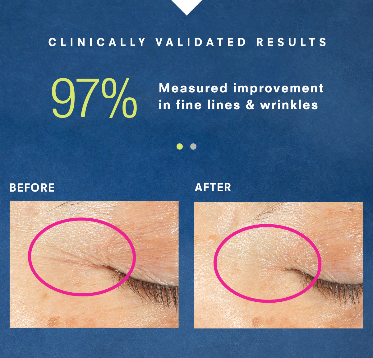 Clinically Validated Results! New STEM CELLULAR SleepWrinkle Retinol Overnight Eye Cream. Shop Now >