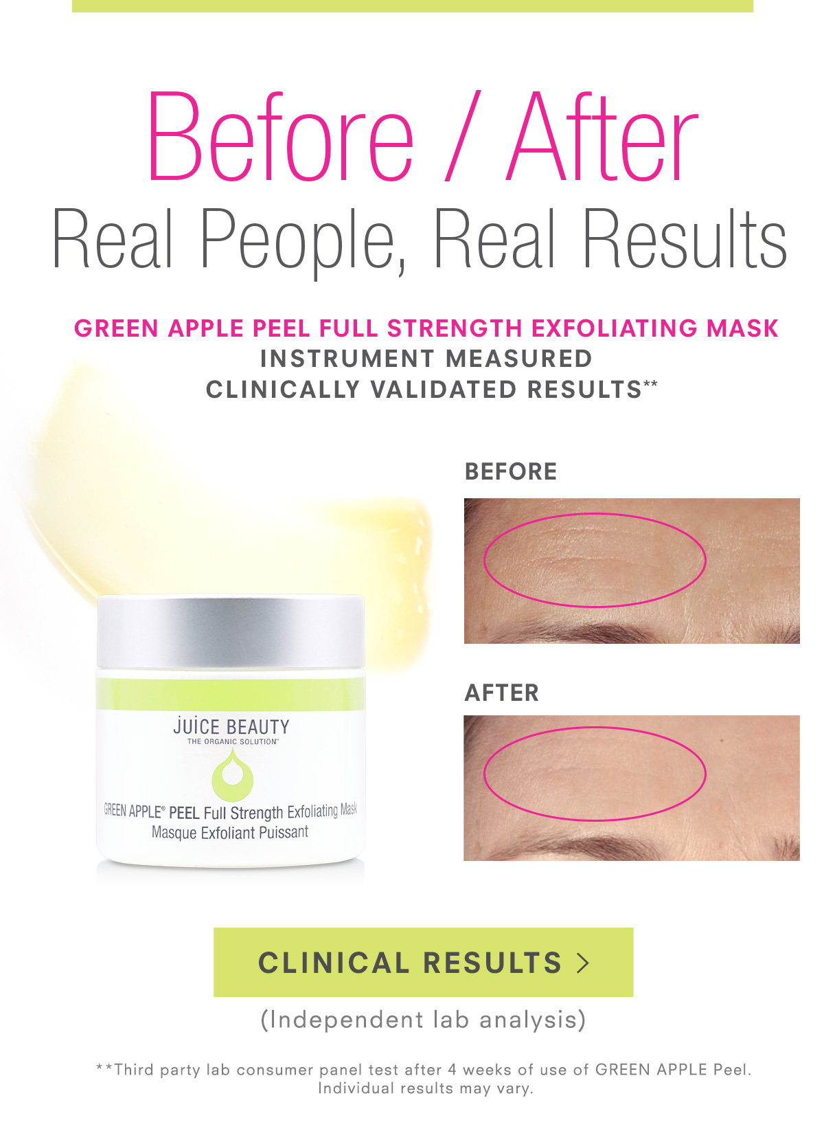 Clinically Validated: GREEN APPLE Peel Full Strength Exfoliating Mask