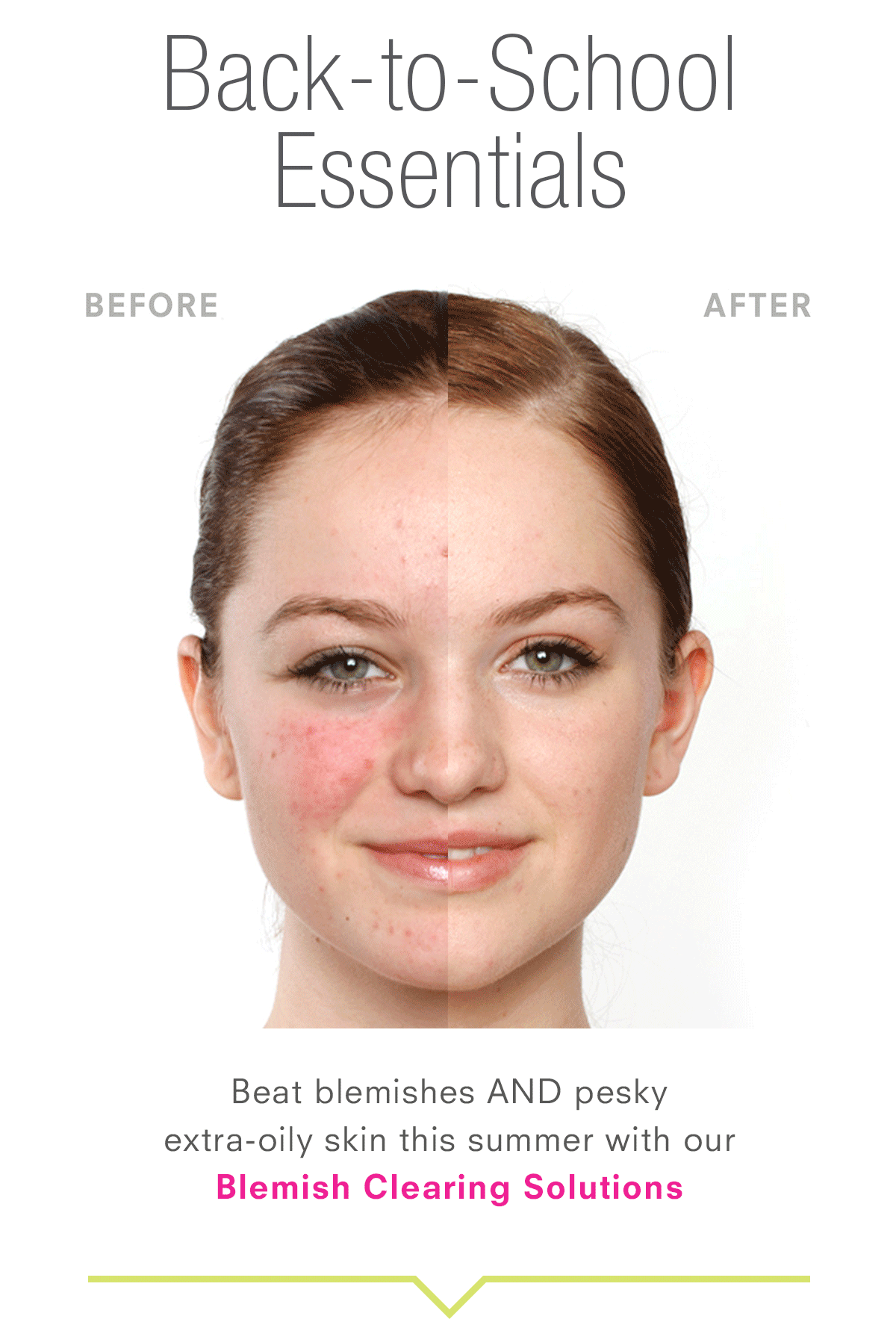 Back to School Essentials. Beat blemishes AND pesky extra-oily skin this summer with our Blemish Clearing Solutions.