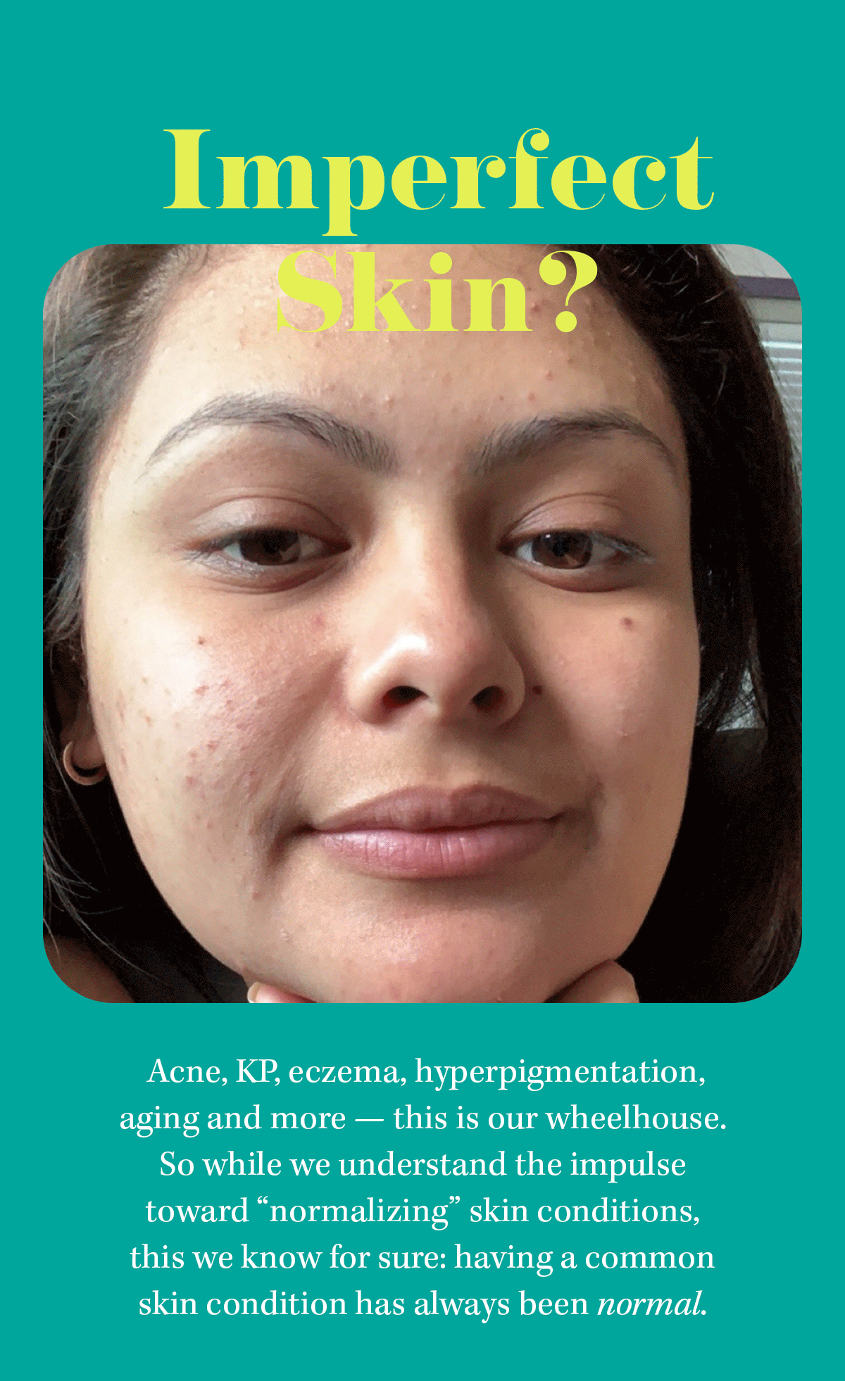 What is a “normal” skin condition? Slmd Skincare