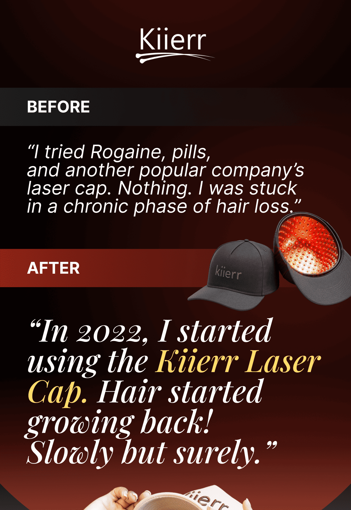 Kiierr Before / After