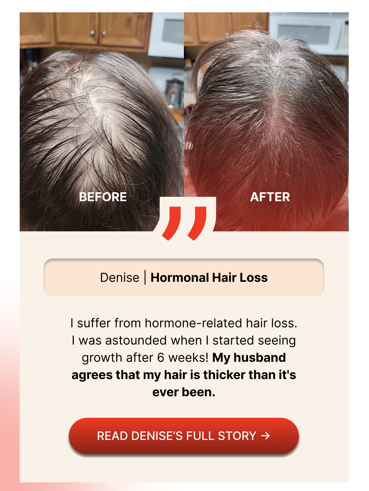 The crown of my head was almost bald.