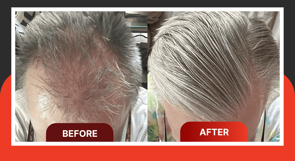 Before / After