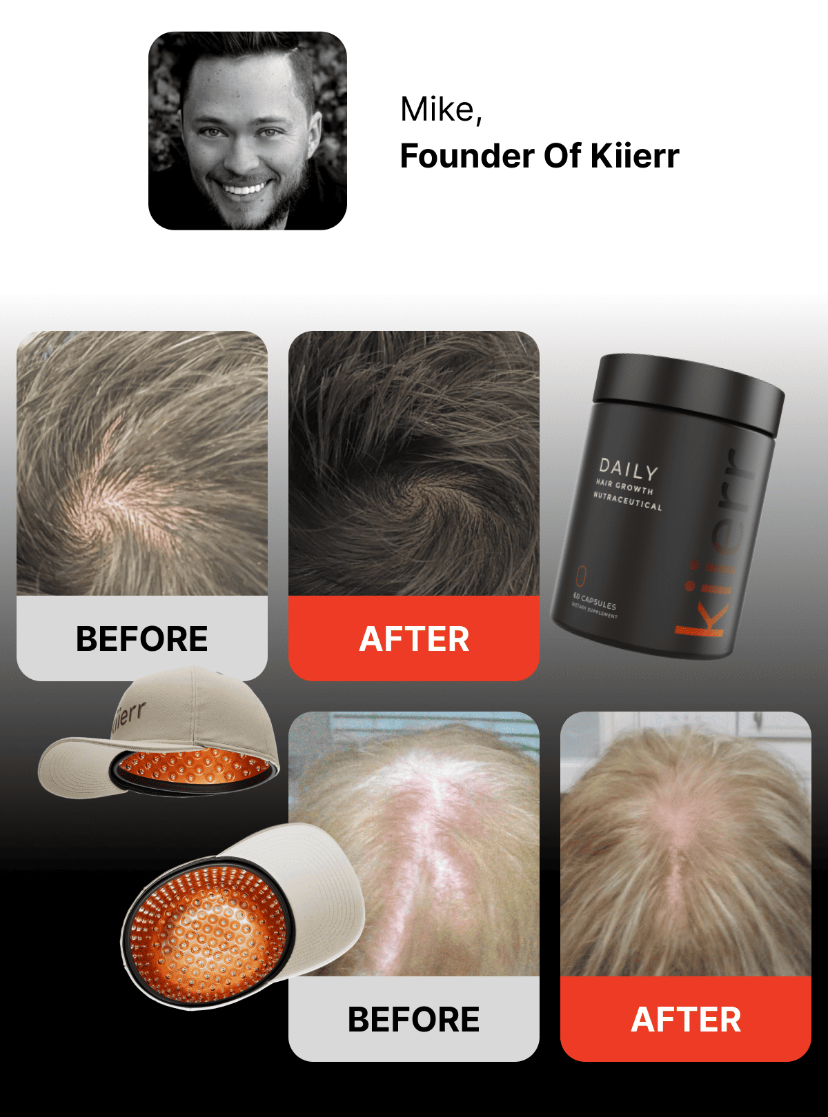 Mike, Founder Of Kiierr Before / After