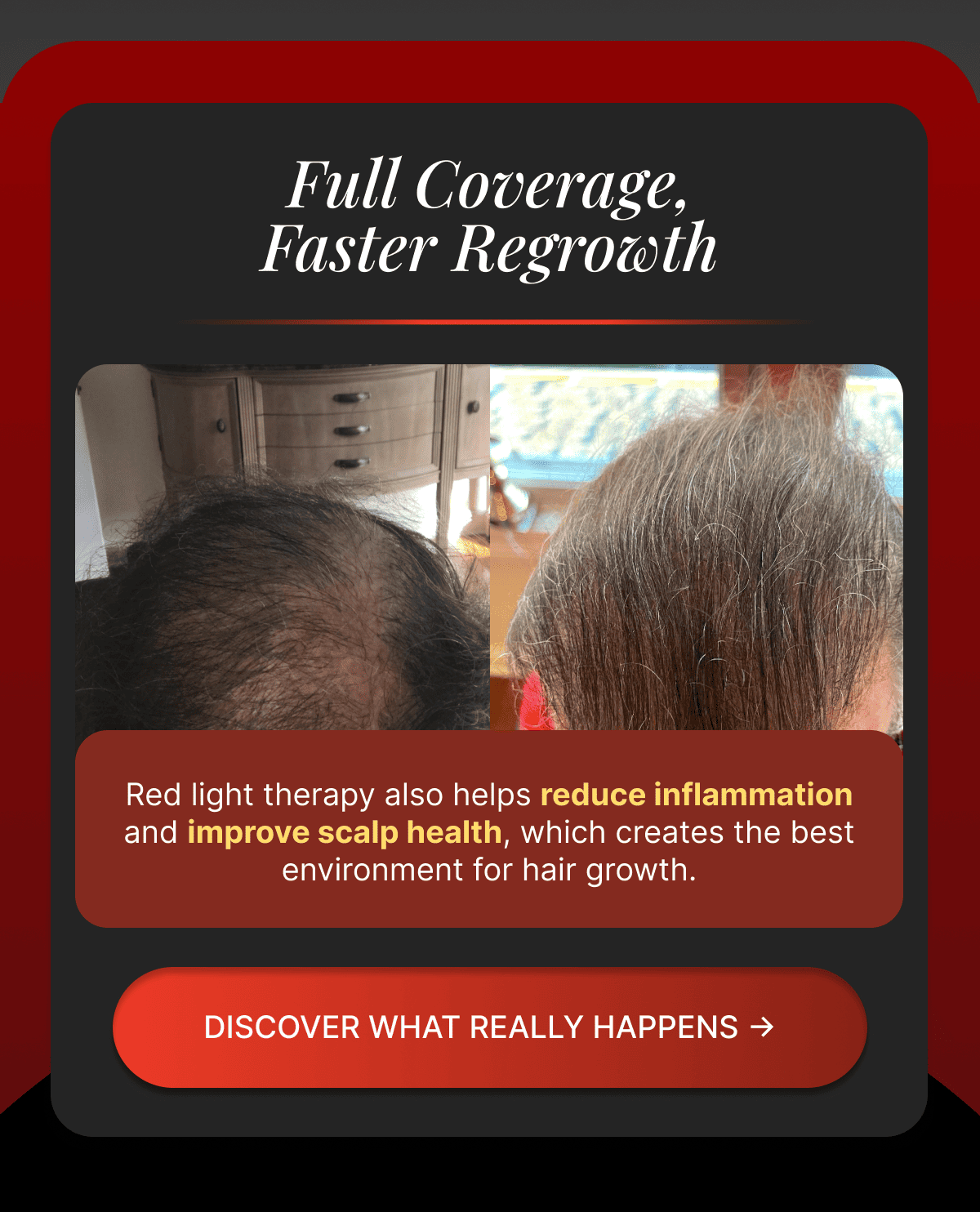 Full Coverage, Faster Regrowth 272 Premier Cap