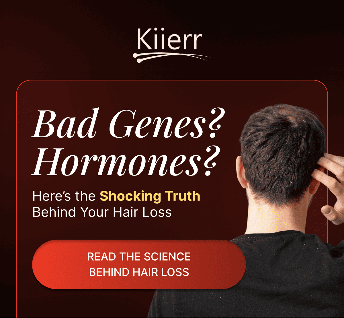 Bad Genes? Hormones? Read The Science Behind Hair Loss