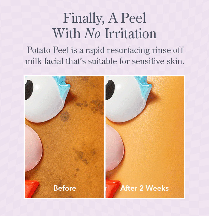 Finally, A Peel With No Irritation! Potato Peel is a rapid resurfacing rinse-off milk facial that's suitable for sensitive skin.