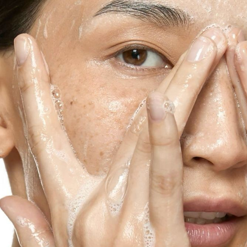 Normal skin Normal skin