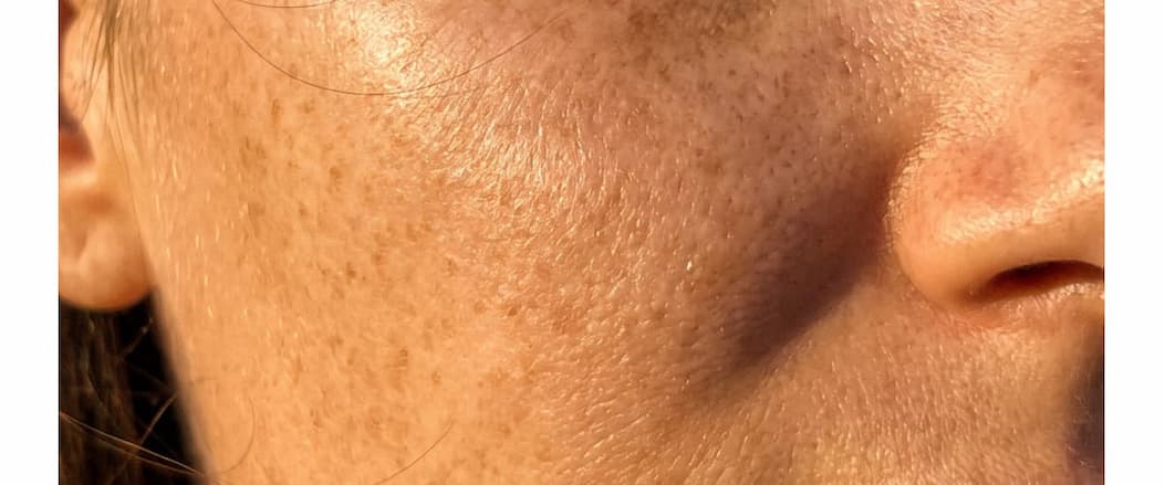 Shop Retinol