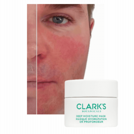 SHOP THE MASK SHOP THE MASK