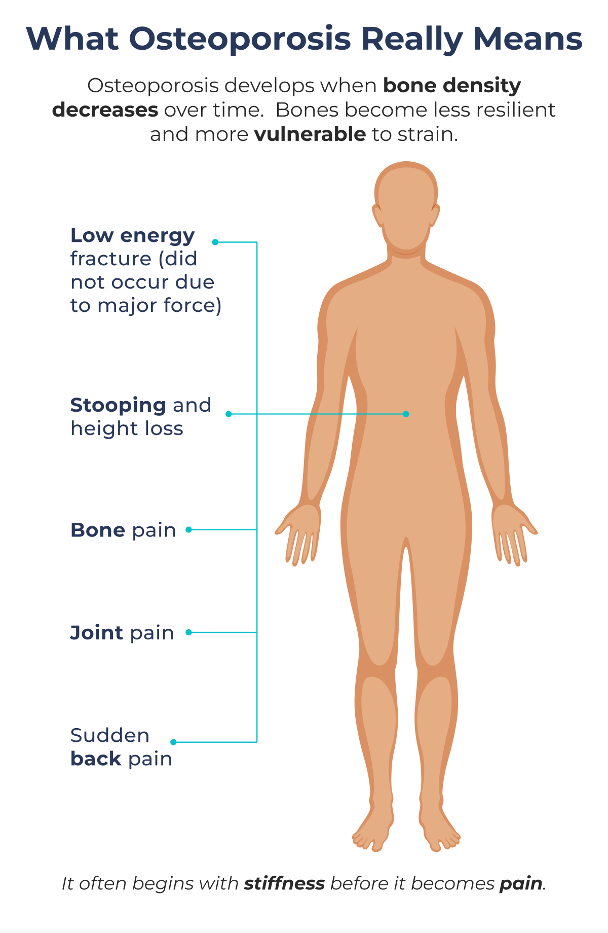 What Osteoporosis Really Means Osteoporosis develops when bone density decreases over time.  Bones become less resilient and more vulnerable to strain. Low energy fracture (did not occur due to major force) Stooping and height loss Bone pain Joint pain Sudden back pain It often begins with stiffness before it becomes pain.