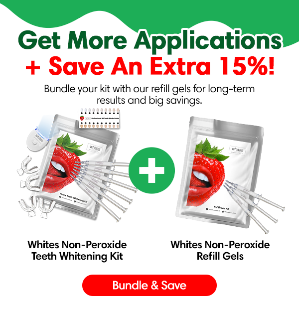 Fast & Safe Home Whitening! 🦷 Whites Beaconsfield