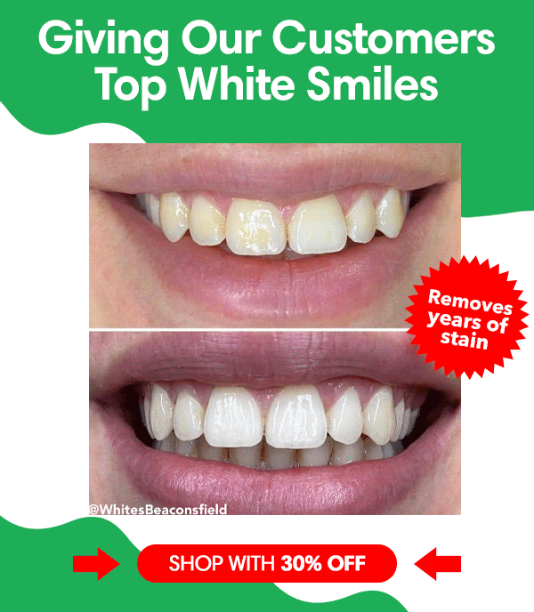 8 Shades Whiter at Home 🤩 Whites Beaconsfield