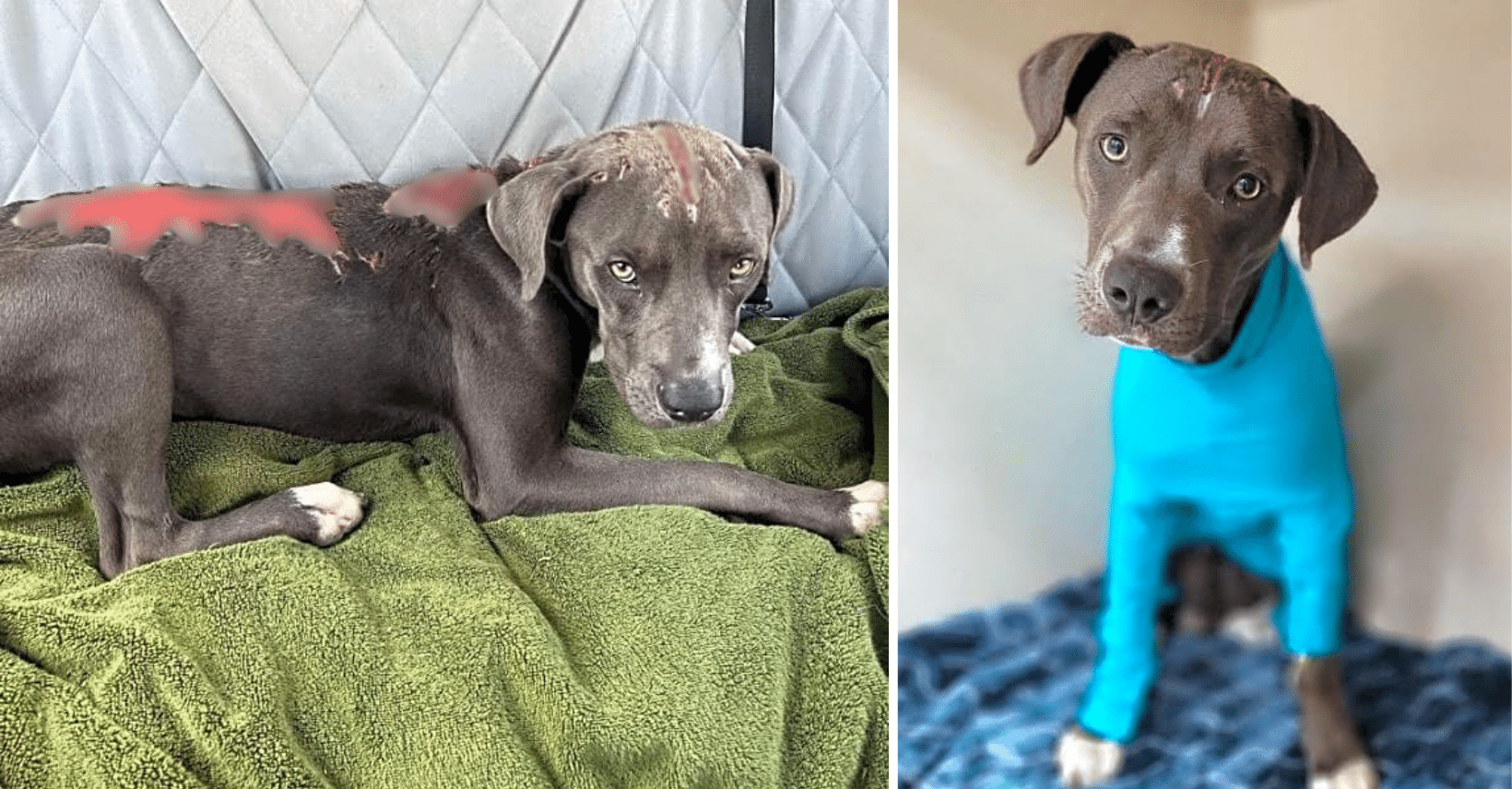 Covered In Chemical Burns, Donovan Endured Life-Alterering Cruelty
