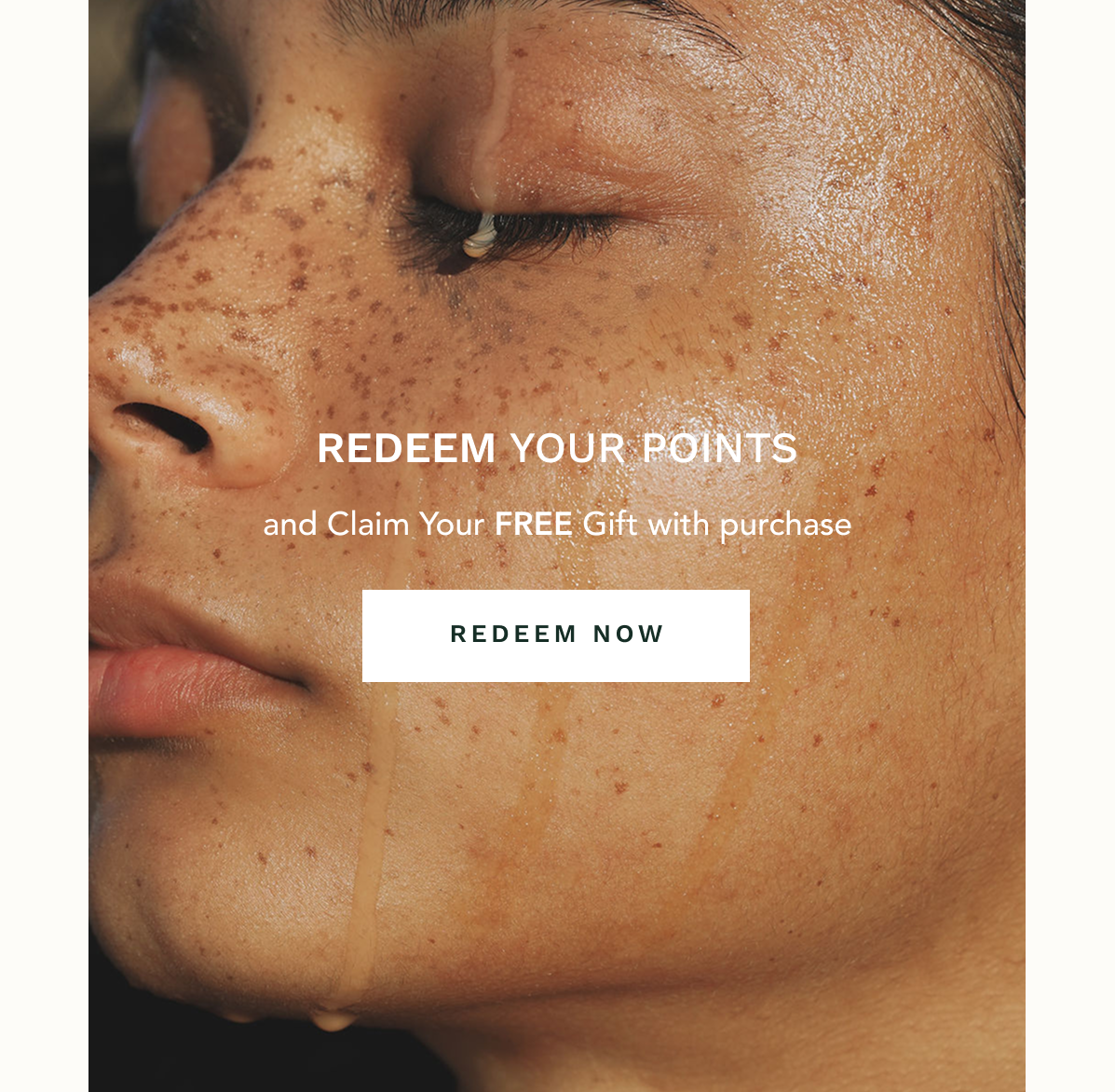 REDEEM NOW