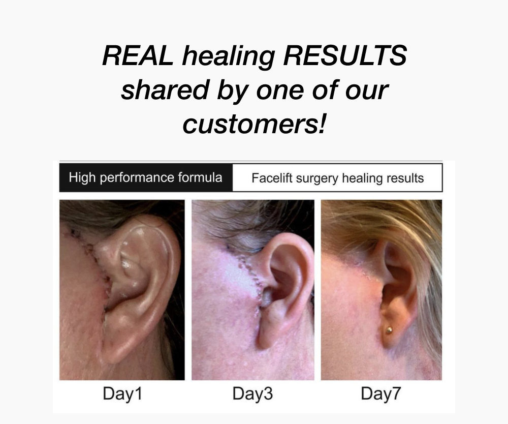 Discover the ultimate healing power of Omega 6 Healing Cream Truth