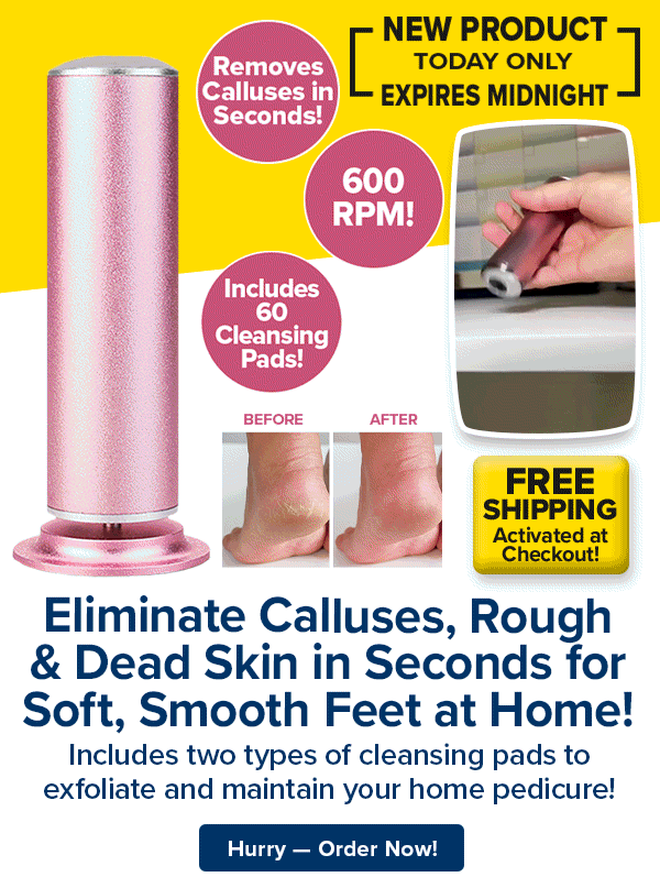 Eliminate Calluses, Rough & Dead Skin in Seconds for Soft, Smooth Feet at Home!