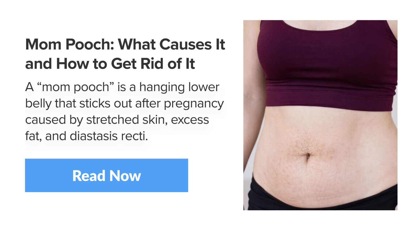 Mom Pooch: What Causes It and How to Get Rid of It