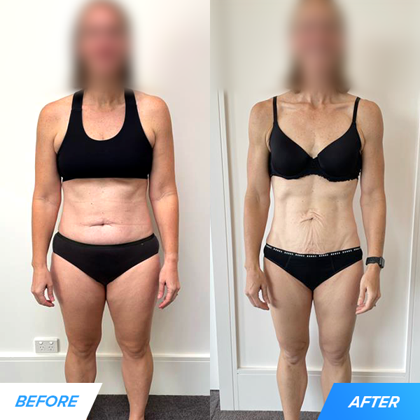 We helped Mary (39) drop 31 pounds and nearly 5% body fat: