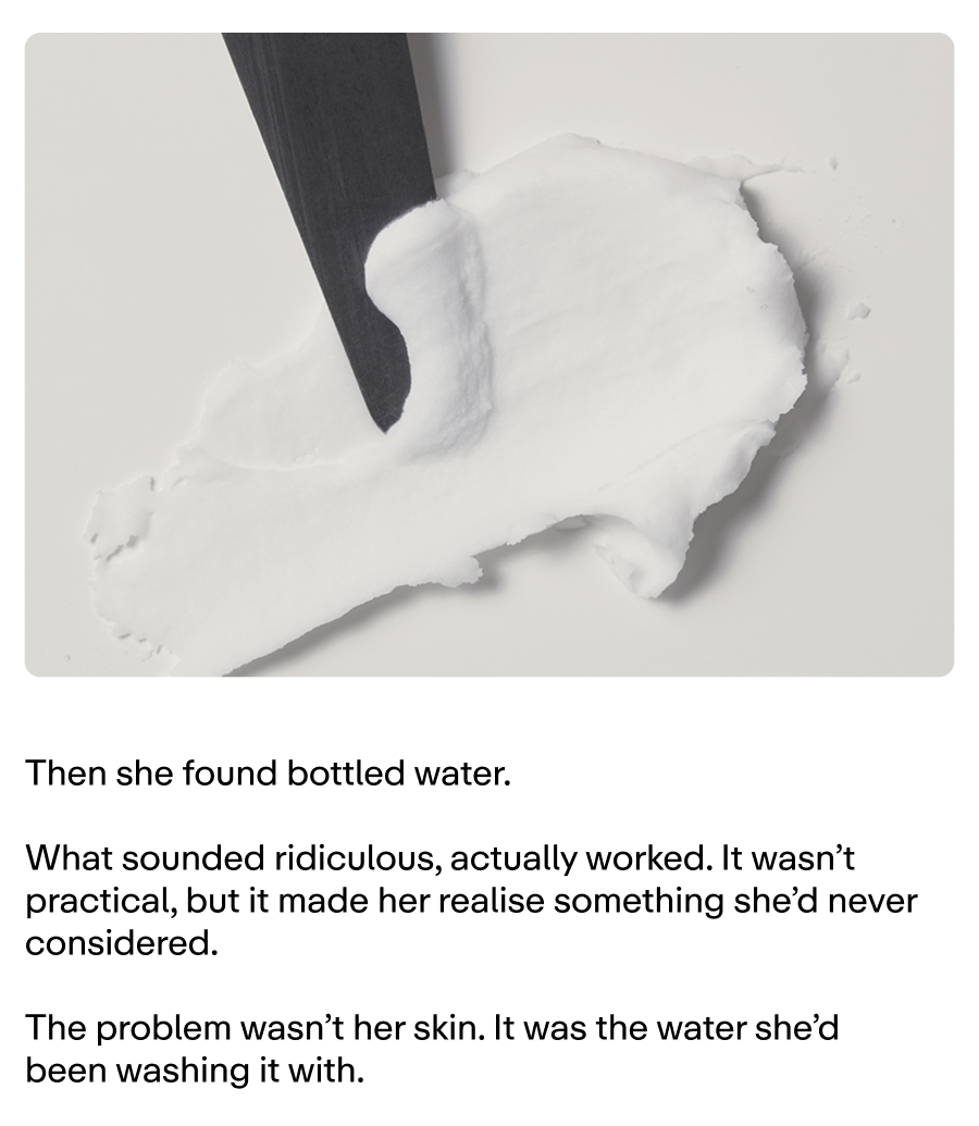 The problem isn't your skin. It's the water you wash with.  