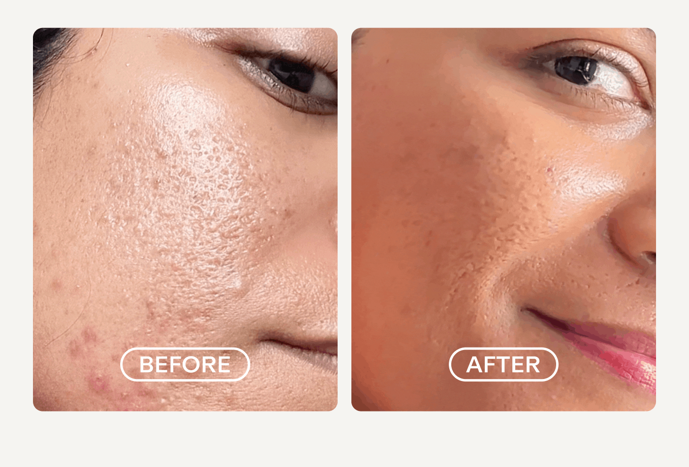 Before and After