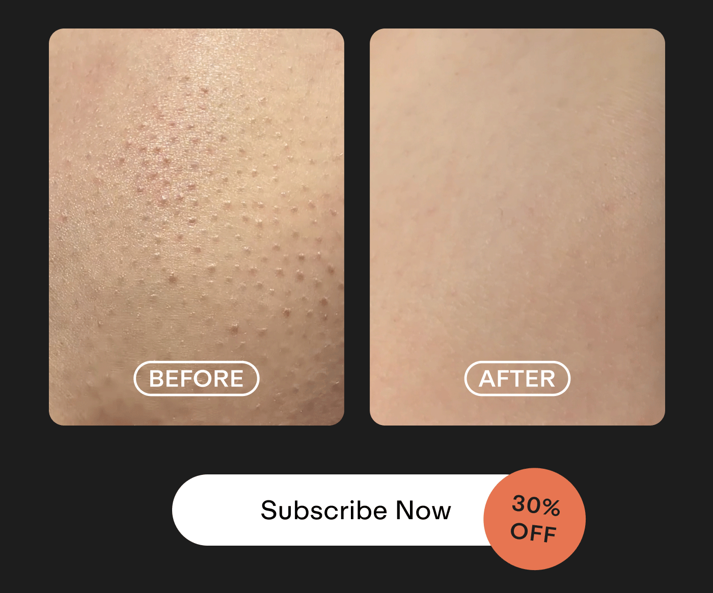 Subscribe Now | 30% OFF