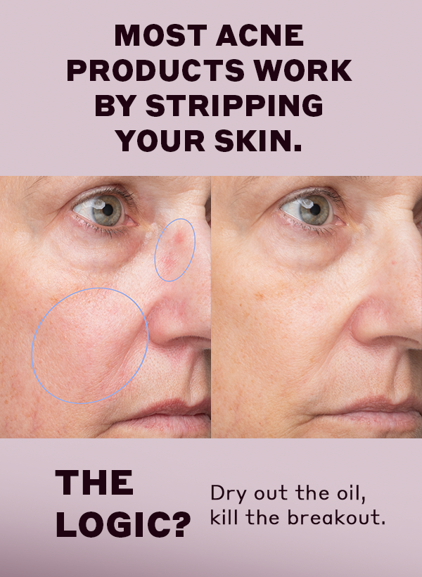 Shop Blemish Flighting Skincare