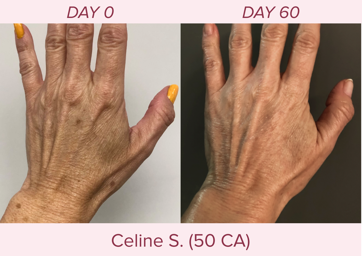 HAVE YOU SEEN The Body Cream? Musely