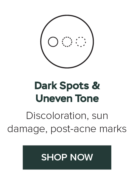 Dark Spots & Uneven Tone