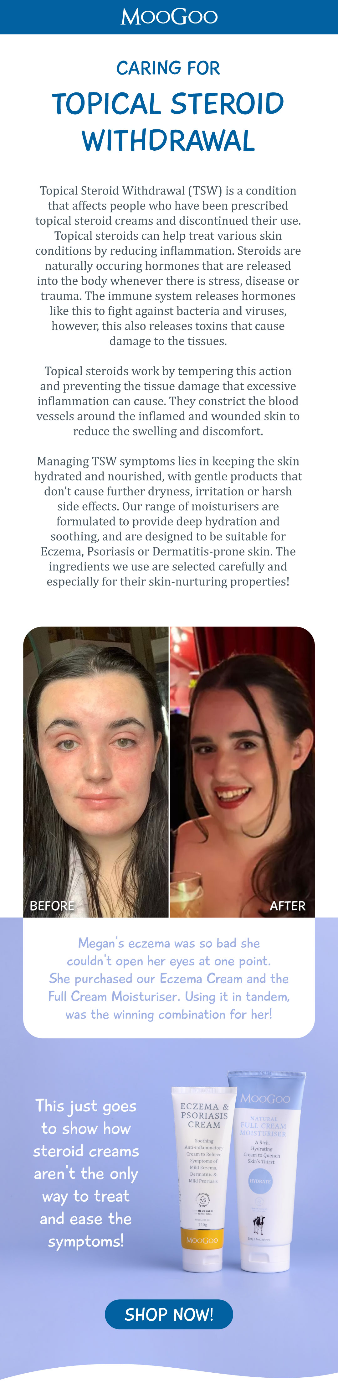 What is topical steroid withdrawal? Moo Goo Skin Care