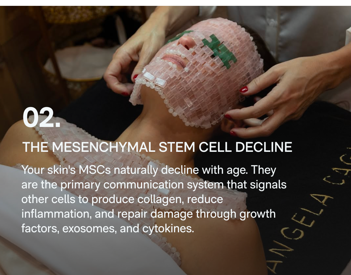 02. The Mesenchymal Stem Cell Decline