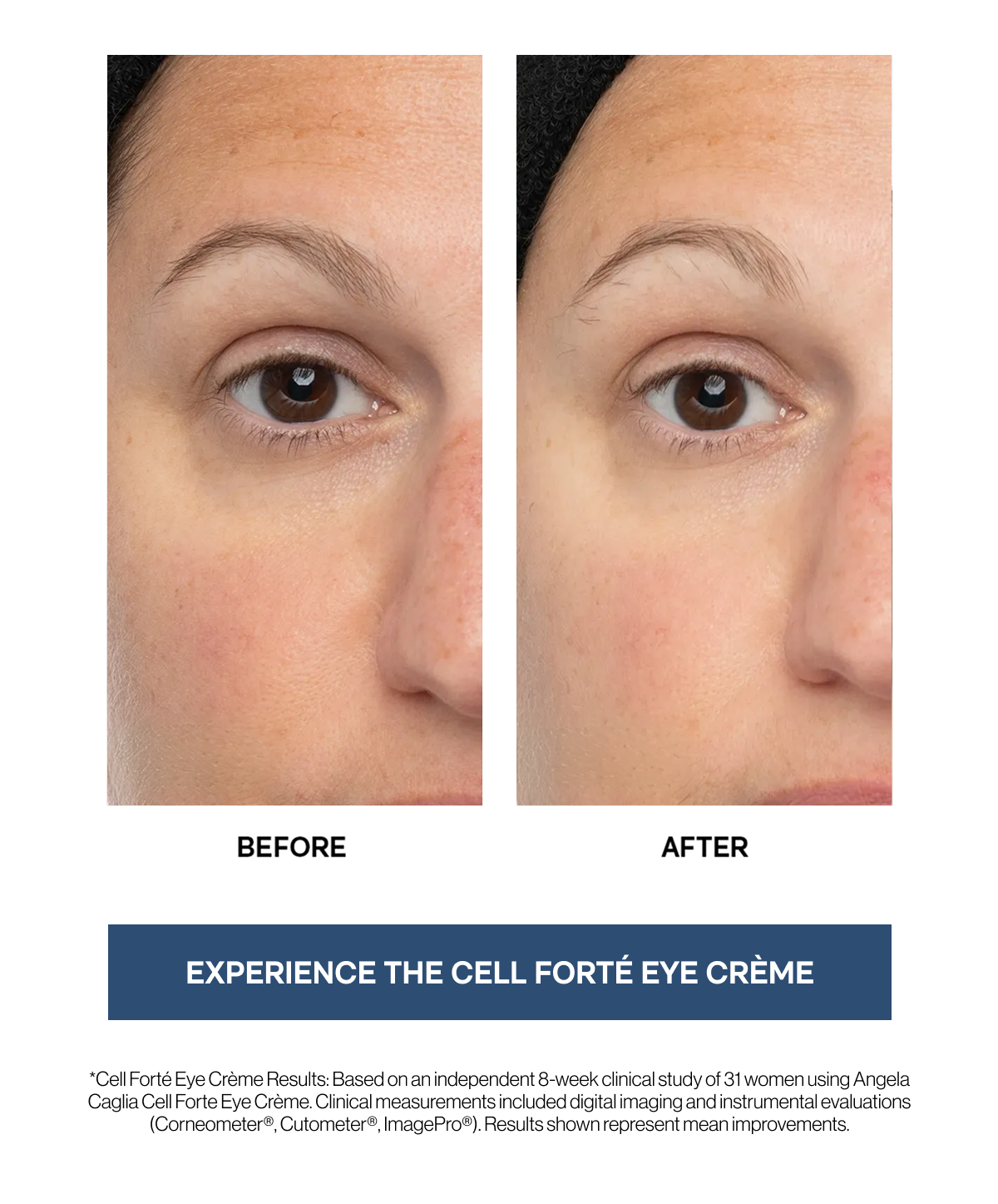 EXPERIENCE THE CELL FORTÉ EYE CRÈME