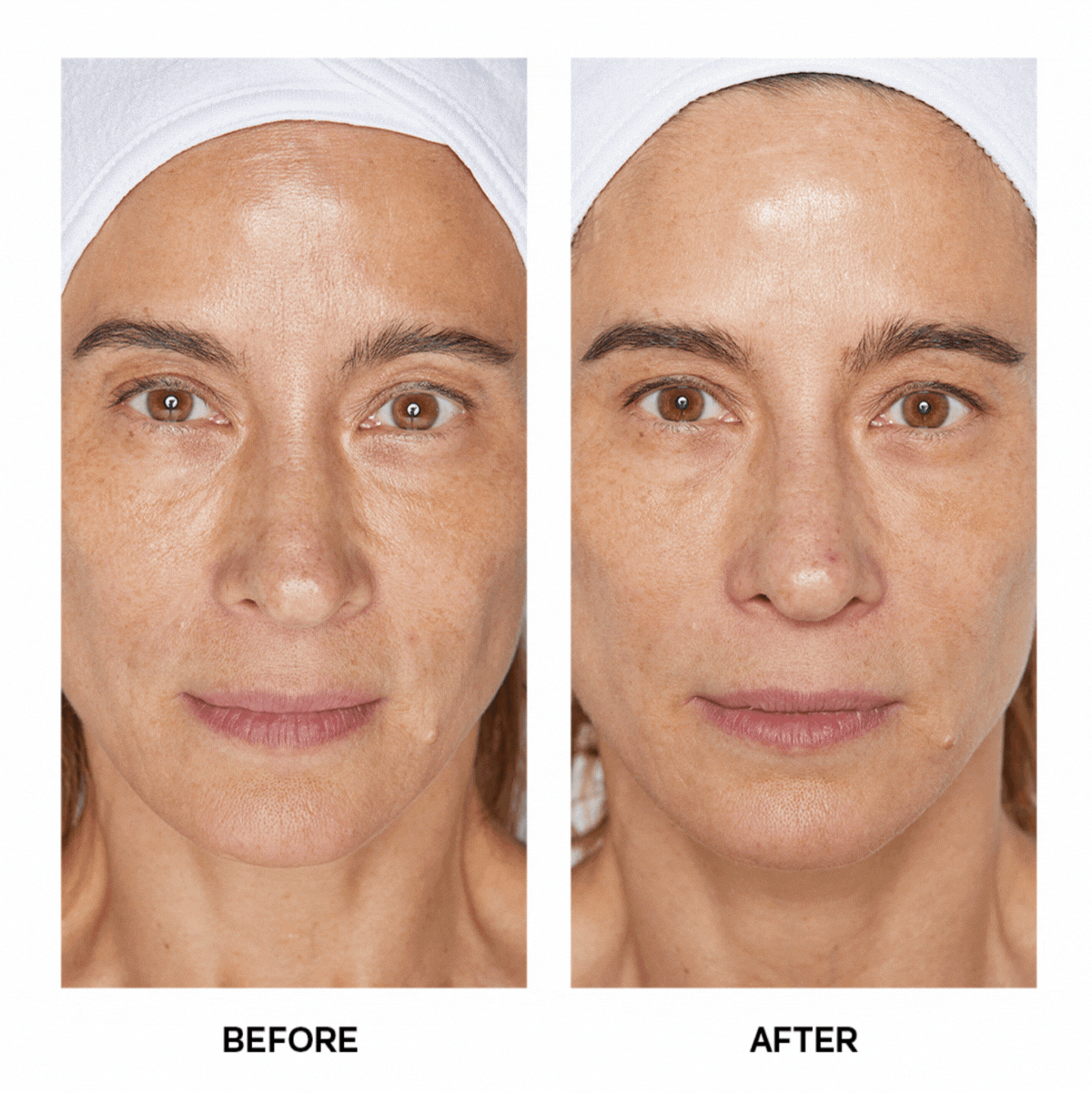 Customer Before & After Images 