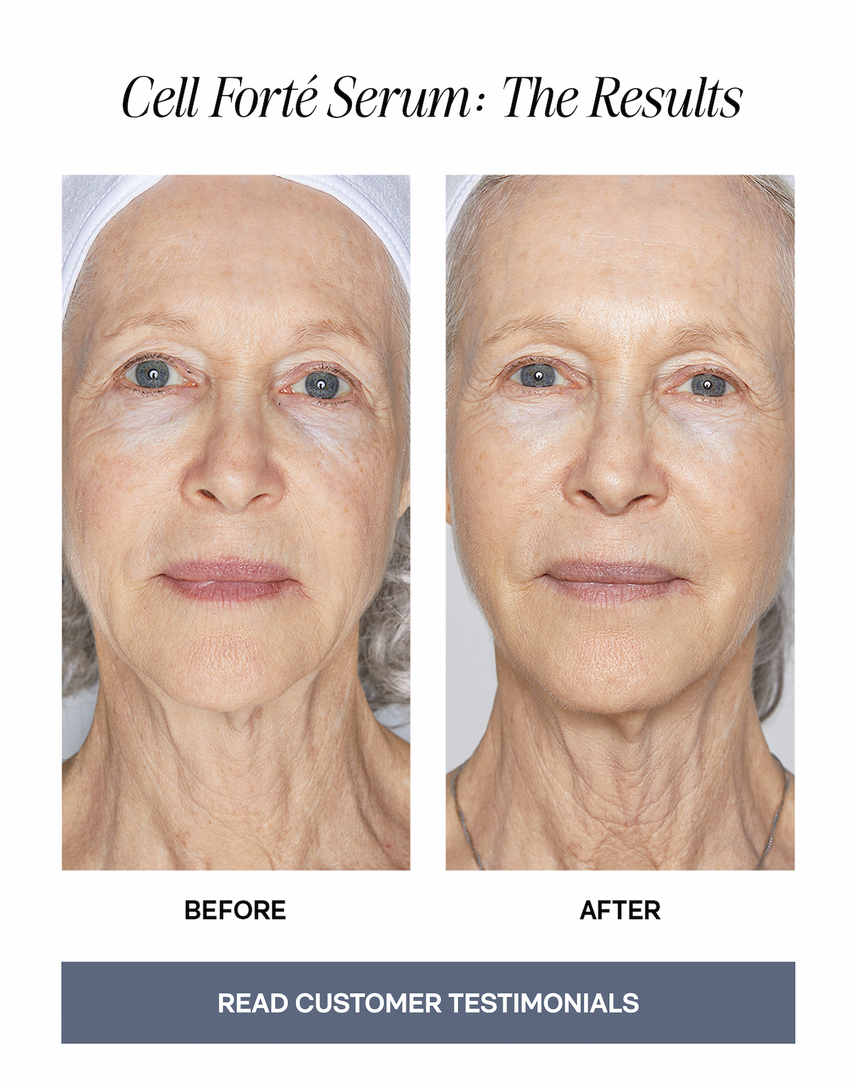Cell Forté Serum: The Results - Before & After - READ CUSTOMER TESTIMONIALS