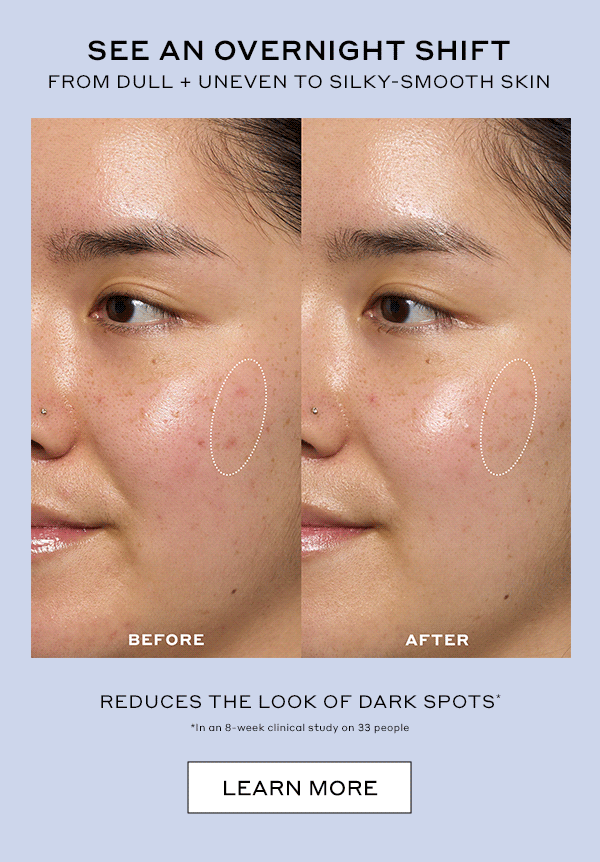 SEE OVERNIGHT SHIFT FROM DULL + UNEVEN TO SILY-SMOOTH SKIN