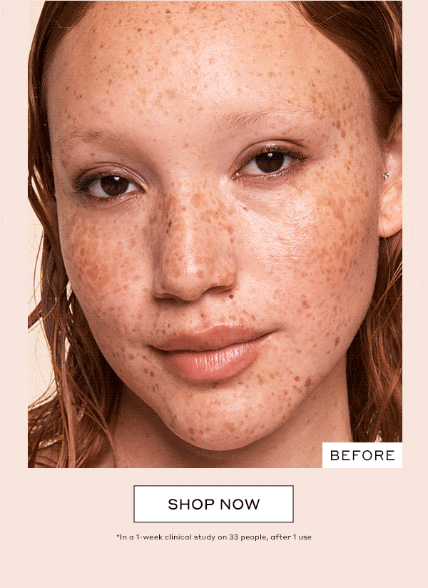 BEFORE | DURING | AFTER | SHOP NOW | *In a 1-week clinical study on 33 people, after 1 use