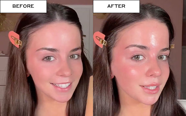 BEFORE | AFTER