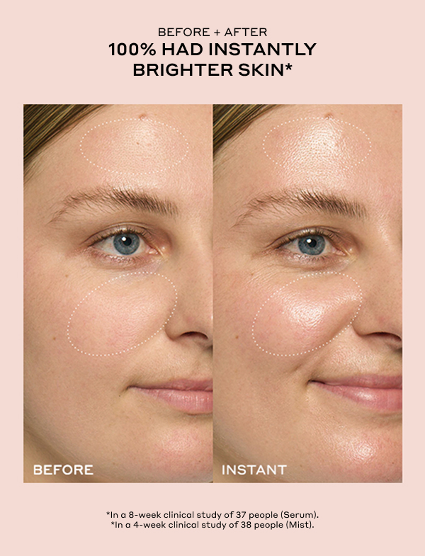 BEFORE + AFTER 100% HAD INSTANTLY BRIGHTER SKIN* *In an 8-week clinical study of 37 people (Serum). *In a 4-week clinical study of 38 people (Mist).