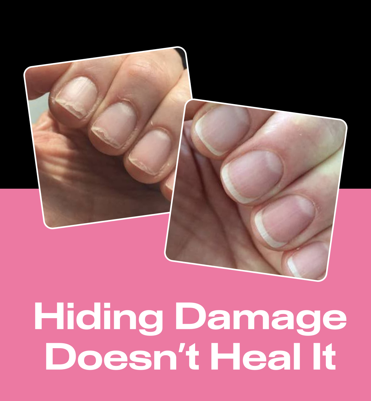 Hiding Damage Doesn't Heal It