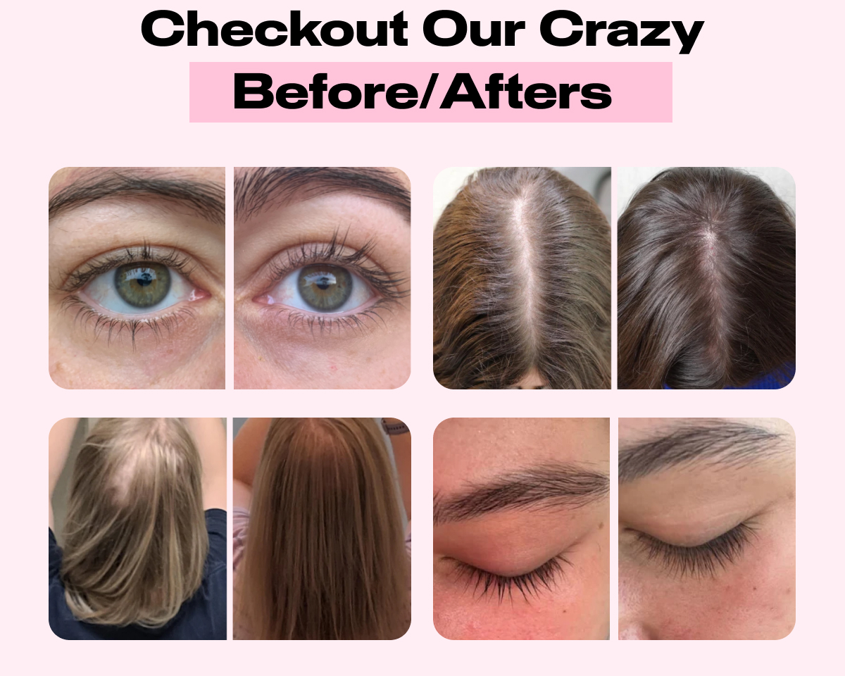 Check Our Crazy Before/Afters