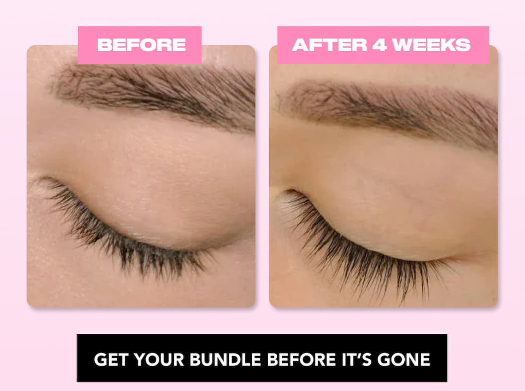 GET YOUR BUNDLE BEFORE IT'S GONE