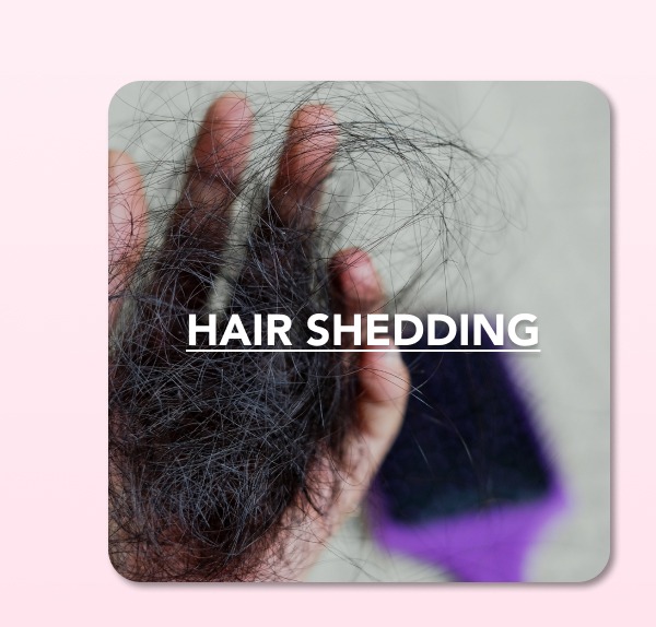 HAIR SHEDDING