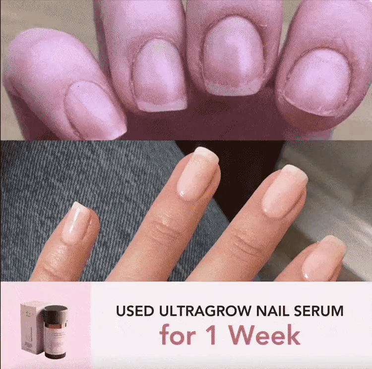 GIF- Before & After