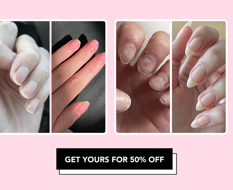 Get Yours For 50% OFF