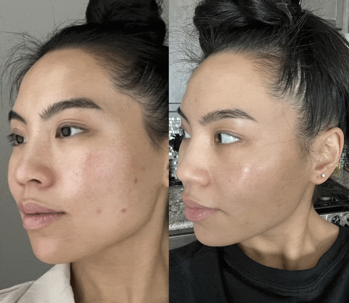 Real Results, Real Before and Afters Vivant Skin Care