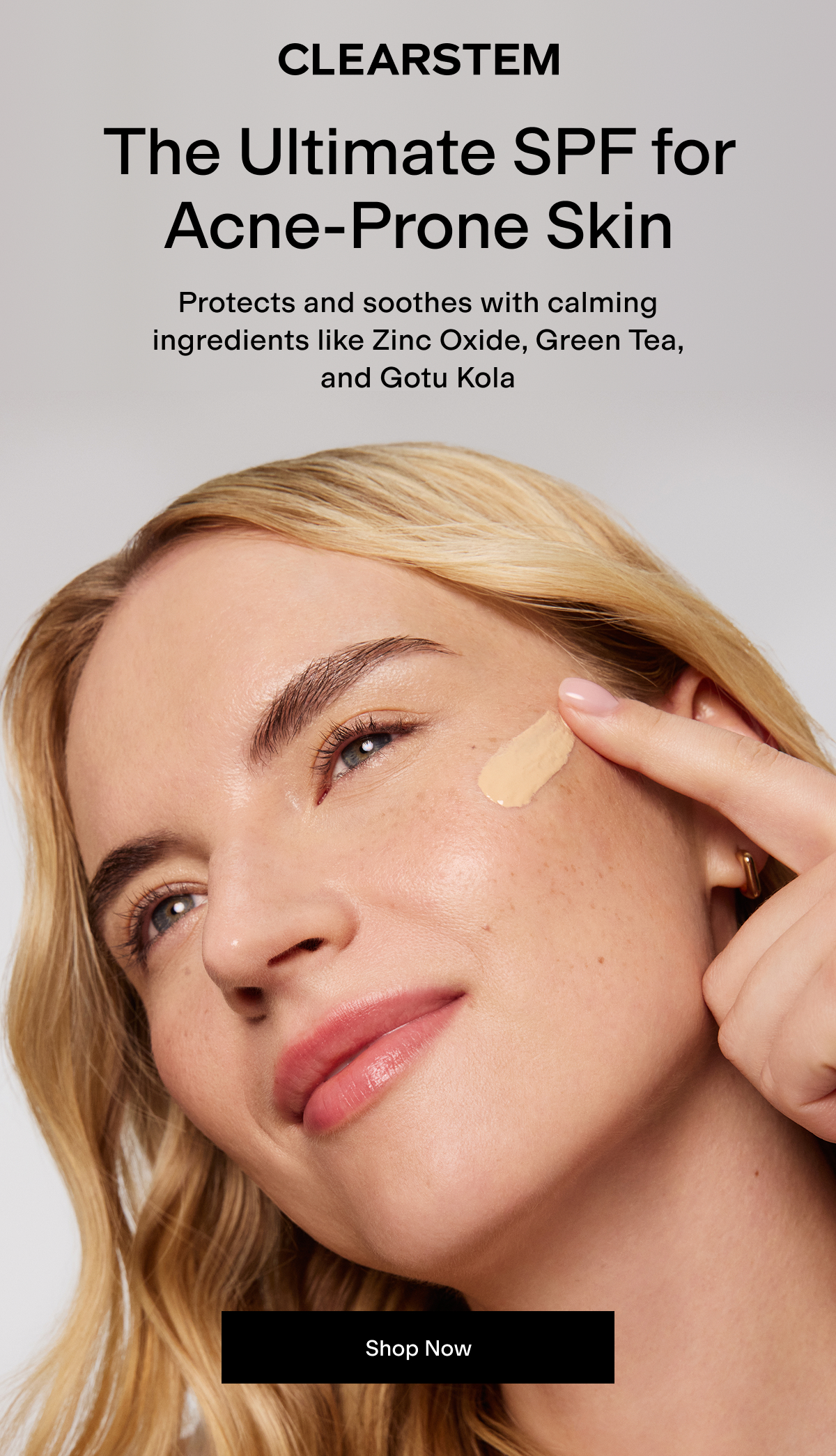 The Ultimate SPF For Acne Prone Skin 