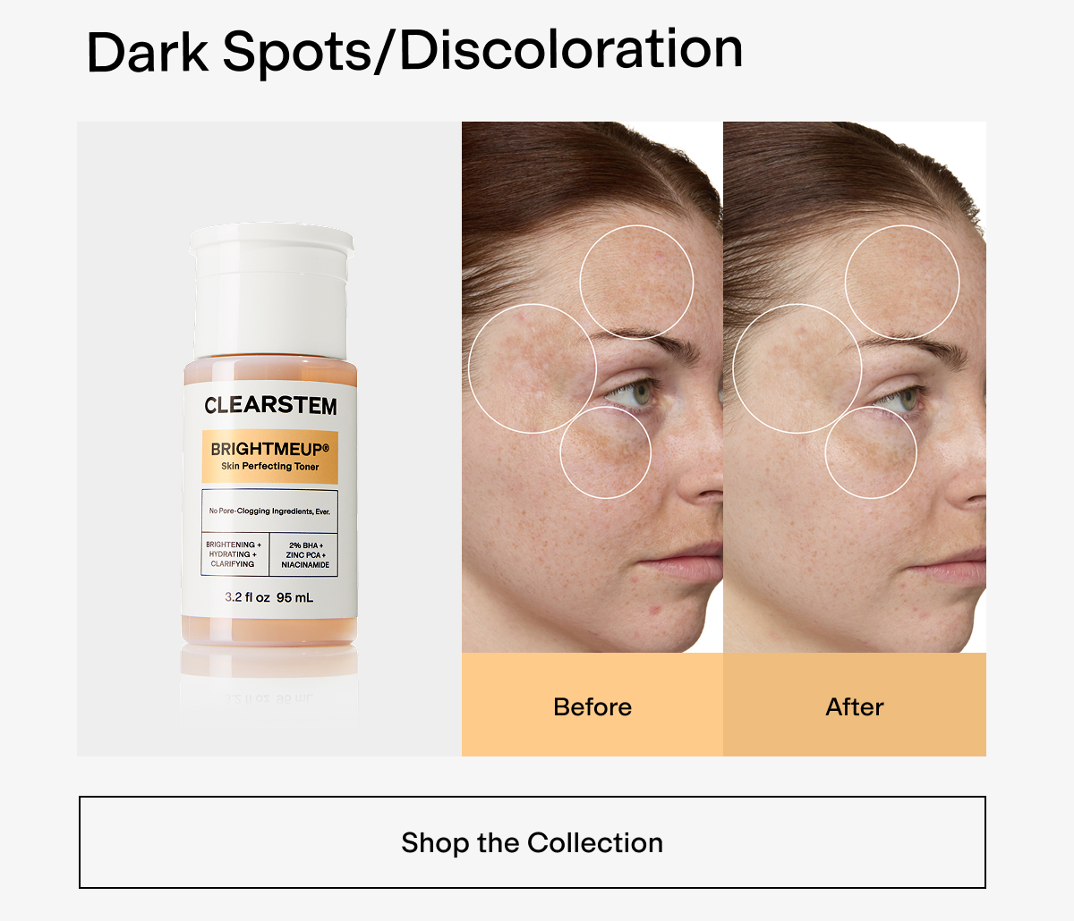 Dark Spots before & after