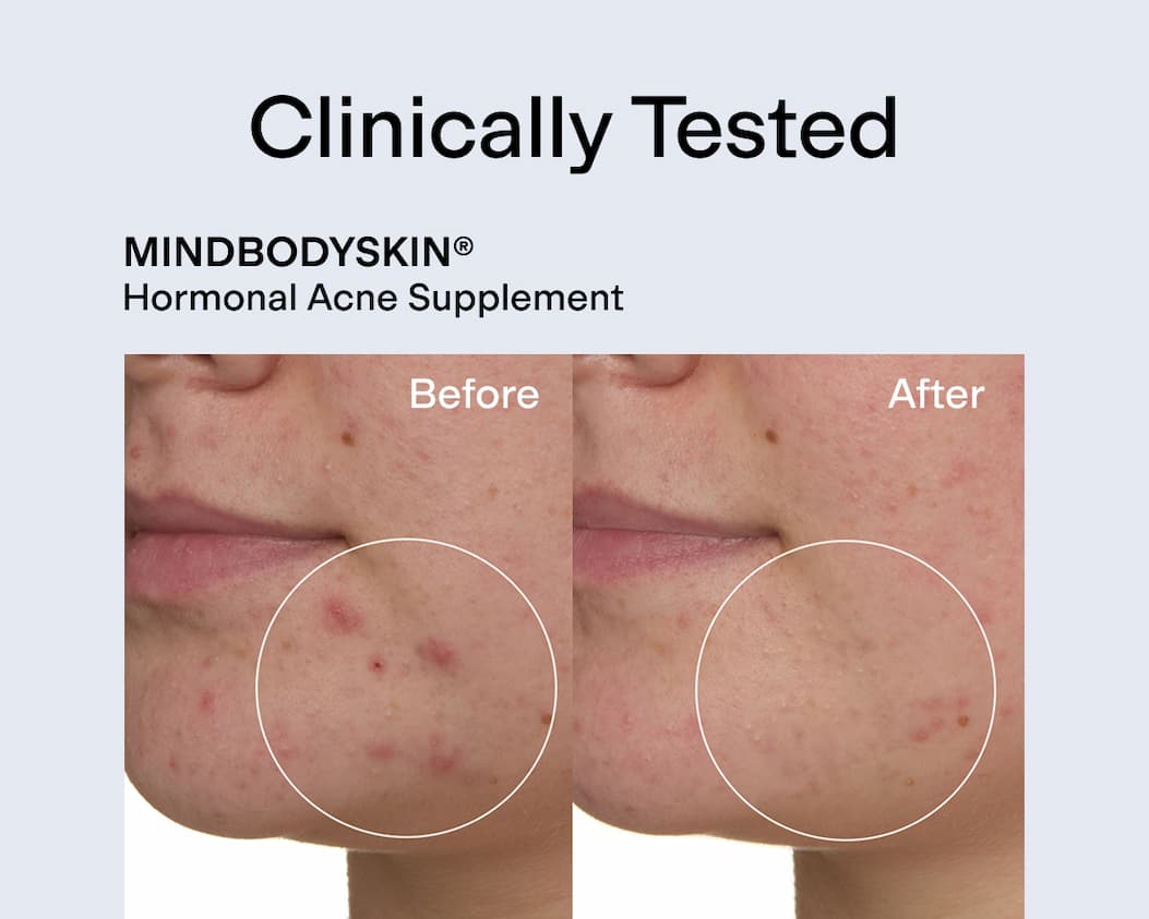25% Off MINDBODYSKIN