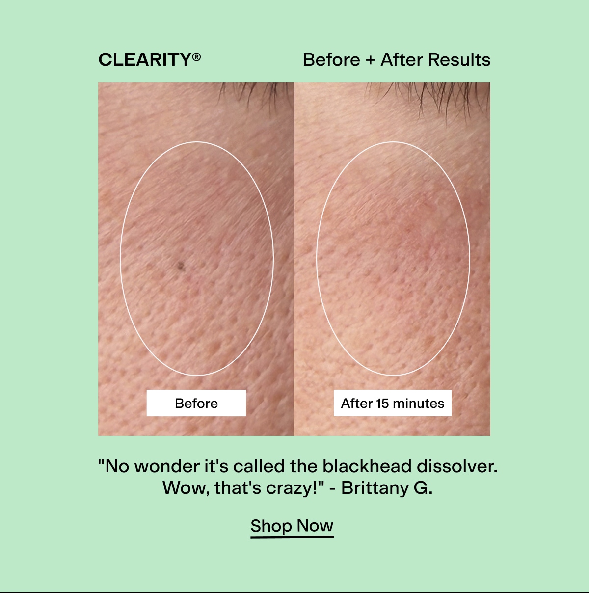 CLEARITY before & after